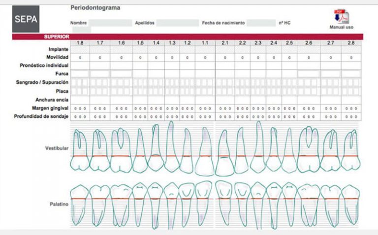 Enfermedad periodontal o periodontitis | Clínica BIO
